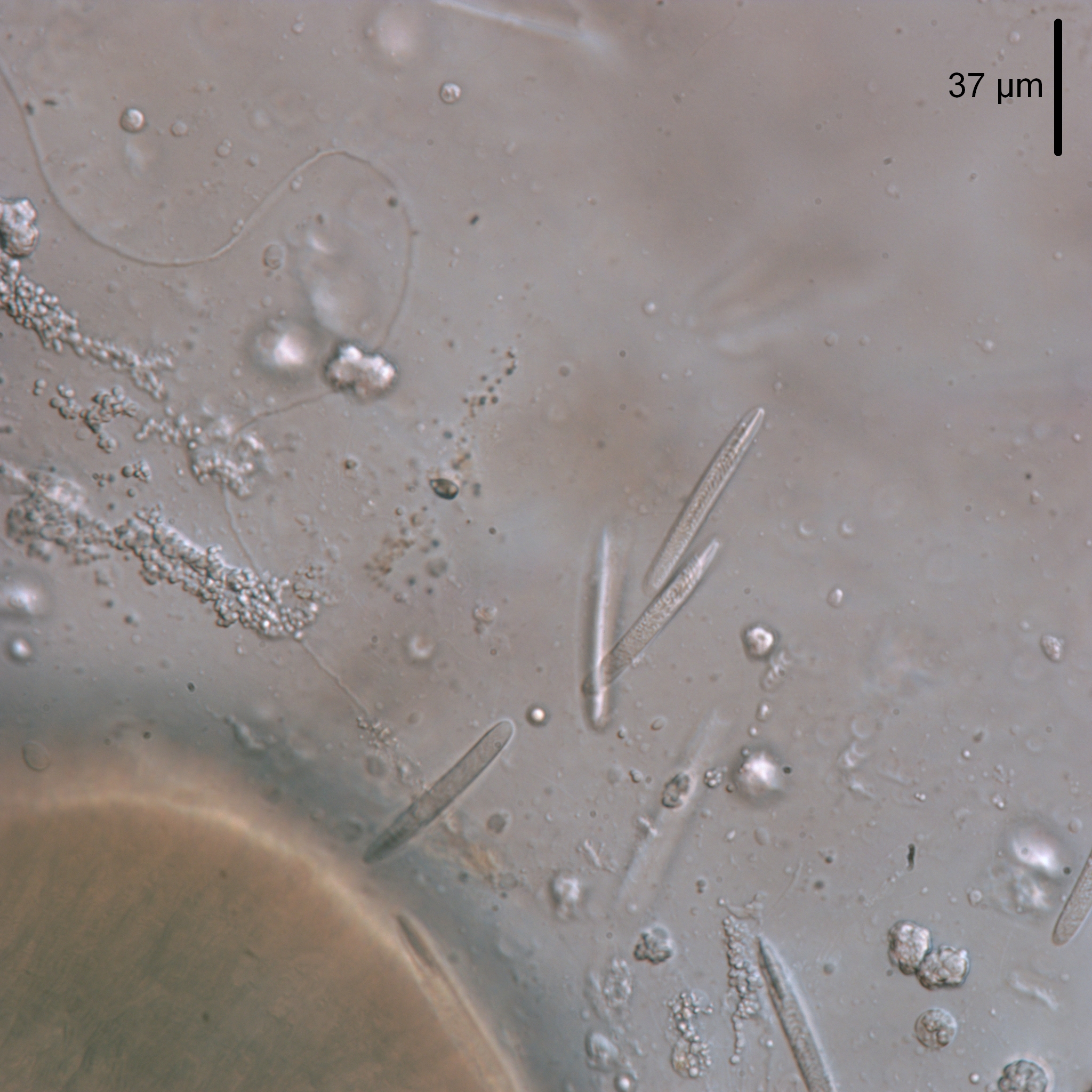 Neomenia megatrapezata